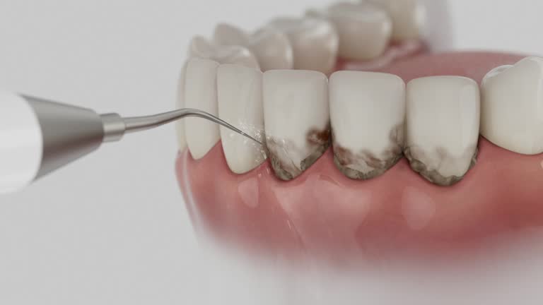 Reliable Dental contractor in Monroe, WI by Smile Center Dentistry